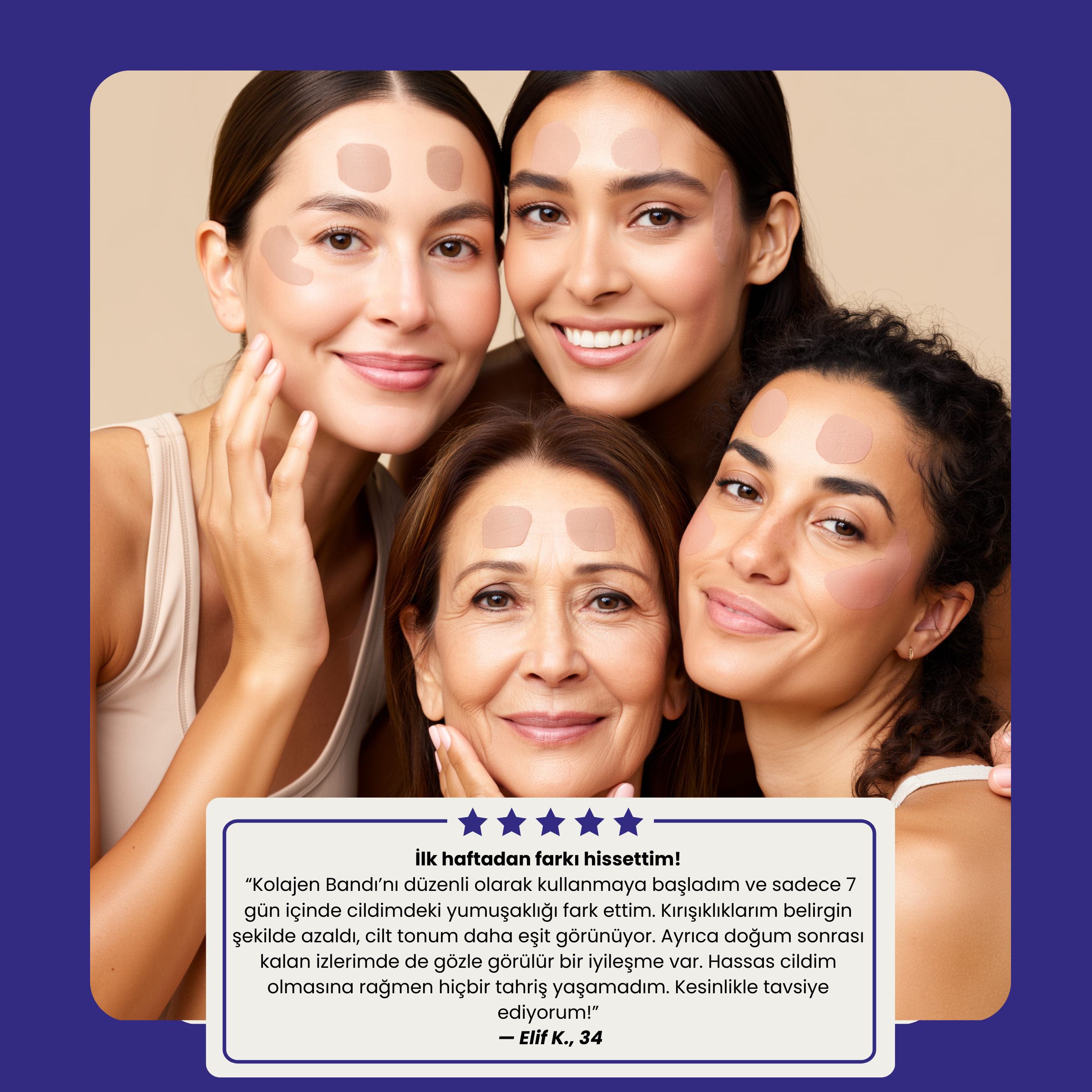 Solye© Kolajen Bant