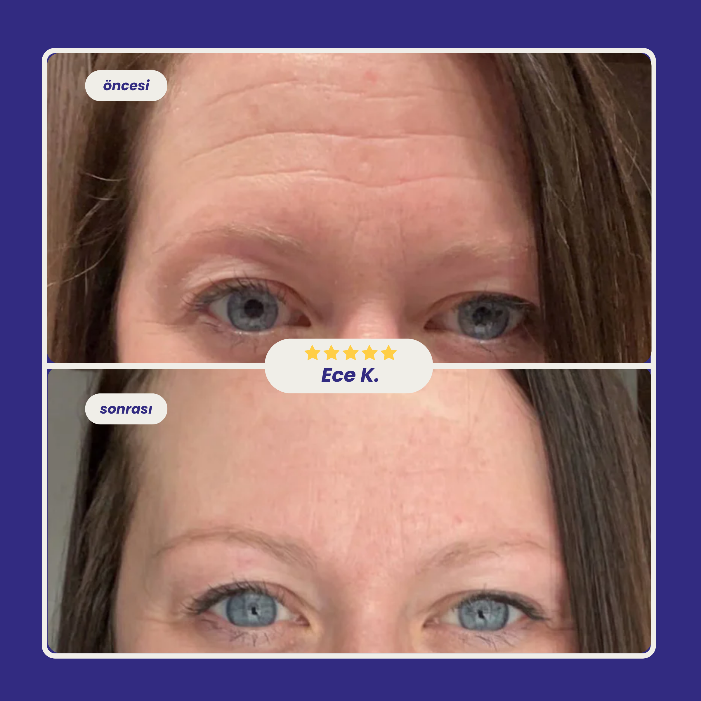 Solye© Kolajen Bant